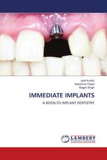 IMMEDIATE IMPLANTS