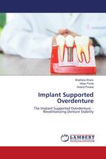 Implant Supported Overdenture