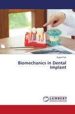 Biomechanics in Dental Implant