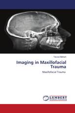 Imaging in Maxillofacial Trauma