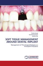 SOFT TISSUE MANAGEMENT AROUND DENTAL IMPLANT