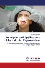 Principles and Applications of Periodontal Regeneration