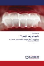 Tooth Agenesis