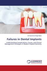 Failures in Dental Implants