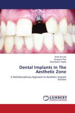 Dental Implants In The Aesthetic Zone