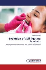 Evolution of Self-ligating brackets