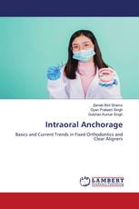 Intraoral Anchorage