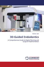 3D-Guided Endodontics