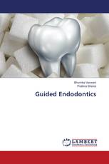 Guided Endodontics