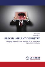PEEK IN IMPLANT DENTISTRY