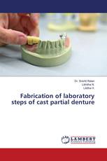 Fabrication of laboratory steps of cast partial denture