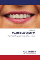 MASTERING VENEERS
