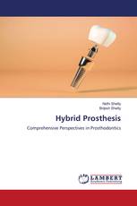 Hybrid Prosthesis