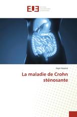 La maladie de Crohn sténosante