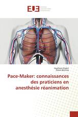 Pace-Maker: connaissances des praticiens en anesthésie réanimation