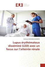 Lupus érythémateux disséminé (LED) avec un focus sur l’atteinte rénale