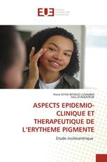 ASPECTS EPIDEMIO-CLINIQUE ET THERAPEUTIQUE DE L’ERYTHEME PIGMENTE