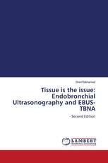 Tissue is the issue: Endobronchial Ultrasonography and EBUS-TBNA