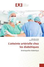 L'atteinte artérielle chez les diabétiques