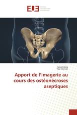 Apport de l’imagerie au cours des ostéonécroses aseptiques