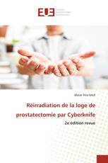 Réirradiation de la loge de prostatectomie par Cyberknife