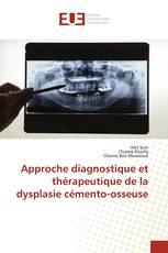 Approche diagnostique et thérapeutique de la dysplasie cémento-osseuse