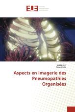 Aspects en Imagerie des Pneumopathies Organisées