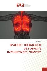 IMAGERIE THORACIQUE DES DEFICITS IMMUNITAIRES PRIMITIFS