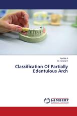Classification Of Partially Edentulous Arch