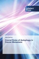 Crucial Roles of Autophagy in Cancer Metastasis