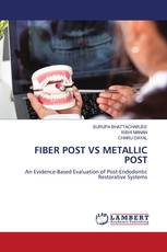 FIBER POST VS METALLIC POST