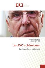 Les AVC ischémiques