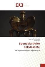 Spondylarthrite ankylosante