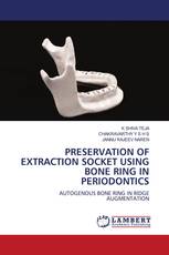 PRESERVATION OF EXTRACTION SOCKET USING BONE RING IN PERIODONTICS
