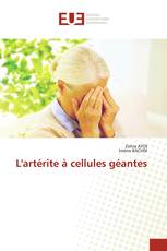 L'artérite à cellules géantes