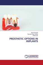 PROSTHETIC OPTIONS IN IMPLANTS