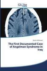 The First Documented Case of Angelman Syndrome in Iraq