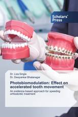 Photobiomodulation: Effect on accelerated tooth movement