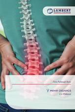 У меня сколиоз