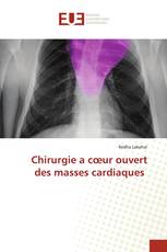 Chirurgie a cœur ouvert des masses cardiaques