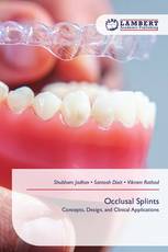 Occlusal Splints