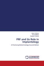 PRF and Its Role in Implantology