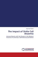 The Impact of Sickle Cell Anaemia