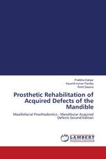 Prosthetic Rehabilitation of Acquired Defects of the Mandible
