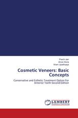 Cosmetic Veneers: Basic Concepts