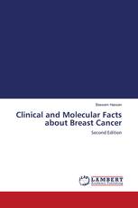 Clinical and Molecular Facts about Breast Cancer