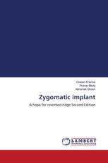 Zygomatic implant