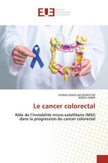 Le cancer colorectal