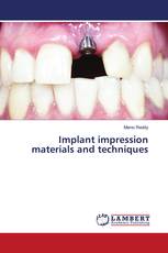 Implant impression materials and techniques