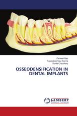 OSSEODENSIFICATION IN DENTAL IMPLANTS